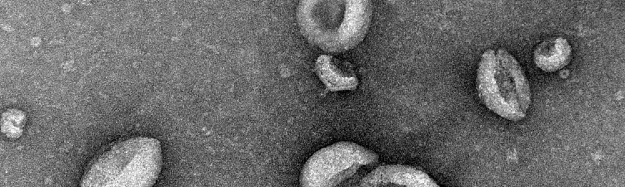image of extracellular vesicles