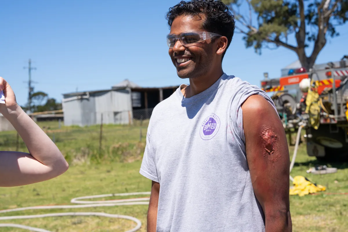 A man outside with a fake wound on his arm