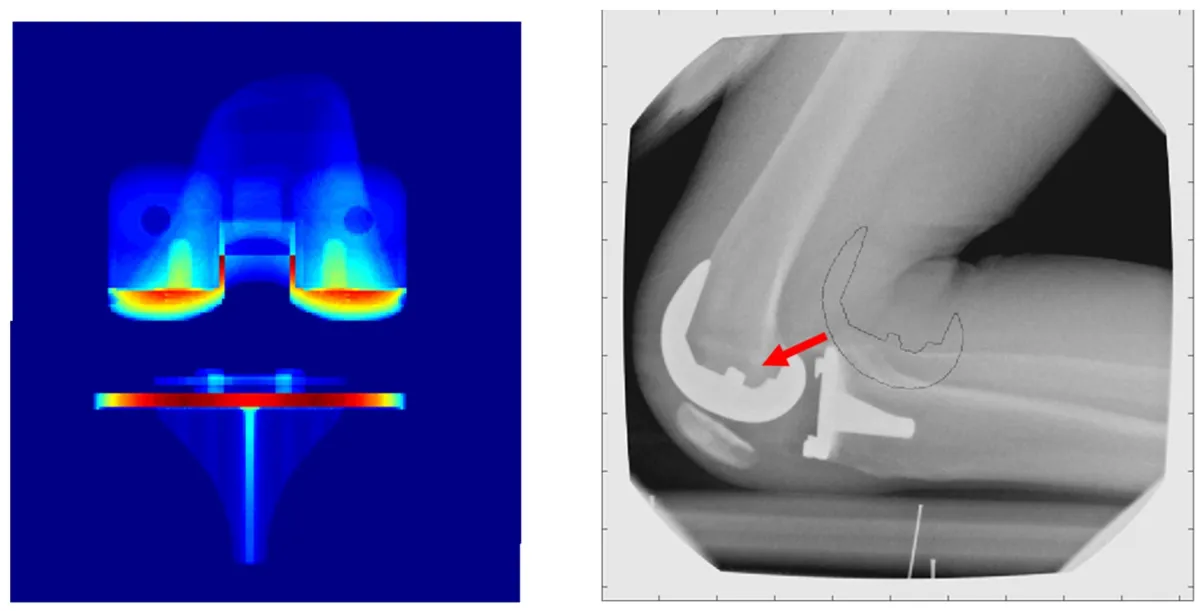 Photo of knee biomechanics