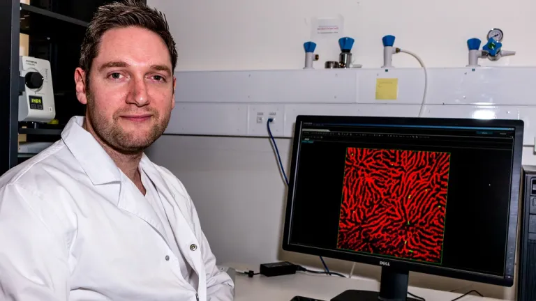 Dr James O'Connor, malaria, research, PhD, MChD, doctor of medicine and surgery, graduation